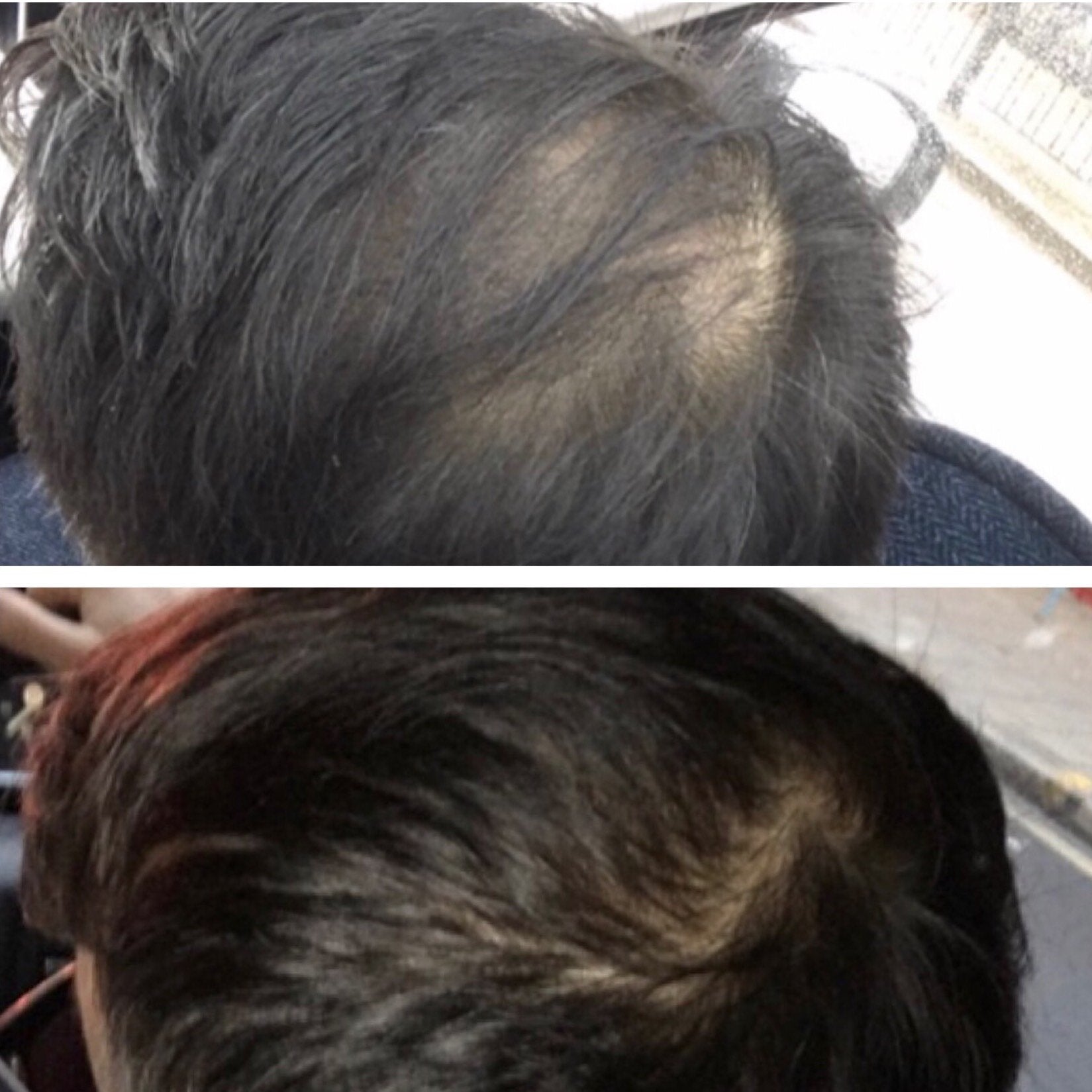 The best collagen supplement for hair loss